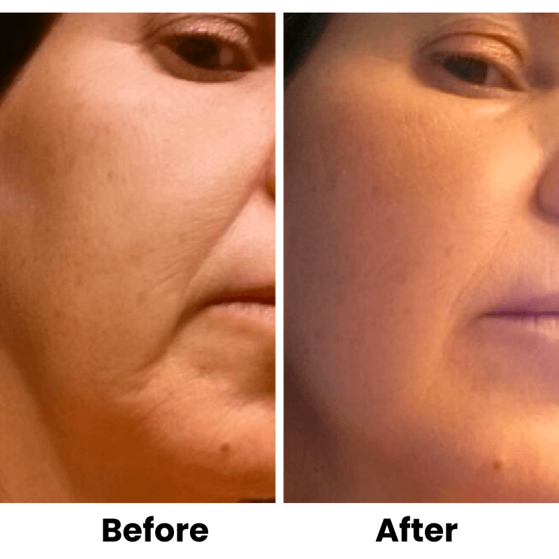 Glow & Sculpt Facial Set