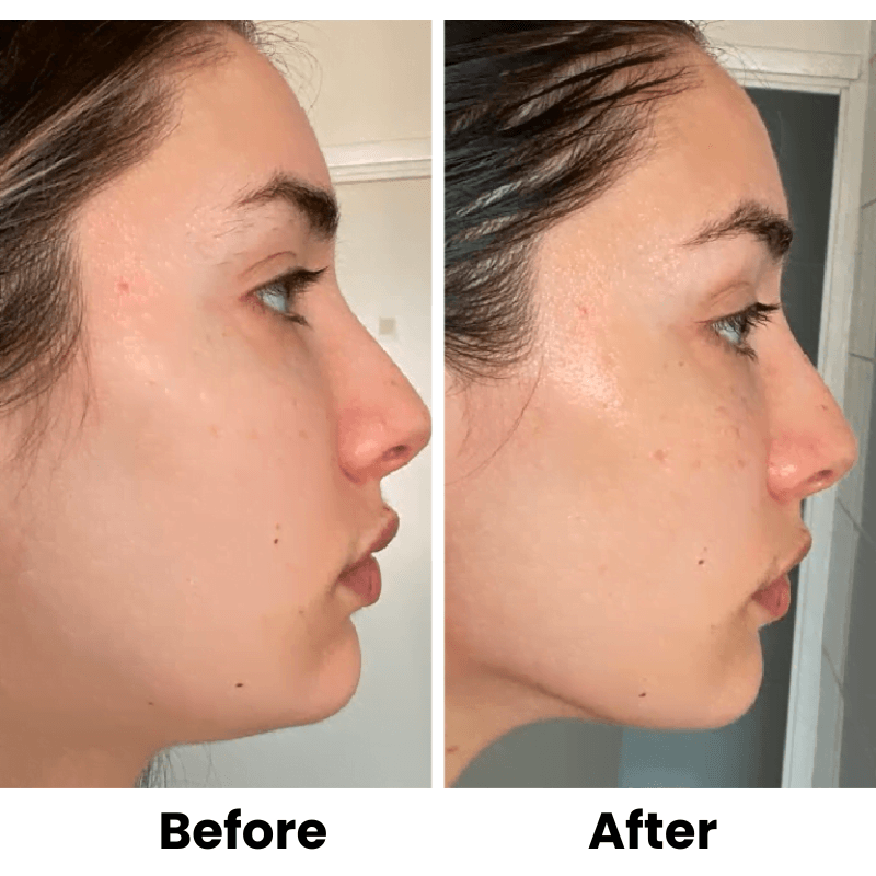 Glow & Sculpt Facial Set