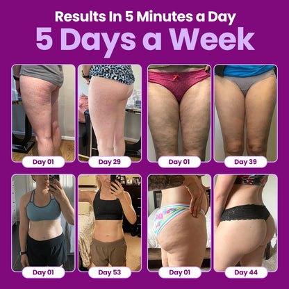 Bareinspire™ CelluTone Pro Cellulite Remover