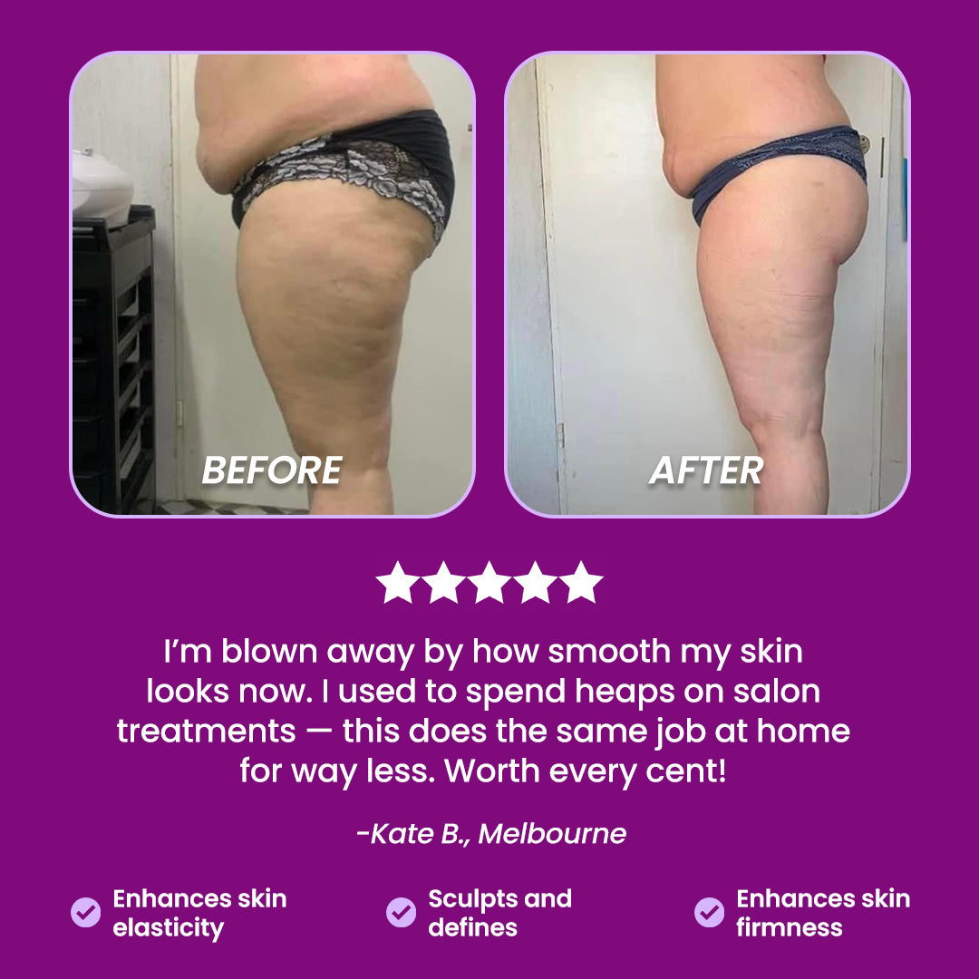 Bareinspire™ CelluTone Pro Cellulite Remover